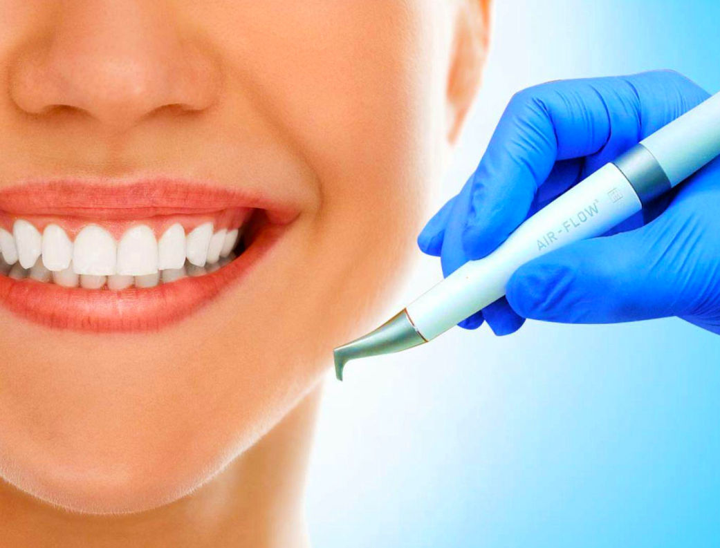   Полный 4х этапный комплекс профессиональной гигиены полости рта в области все зубов